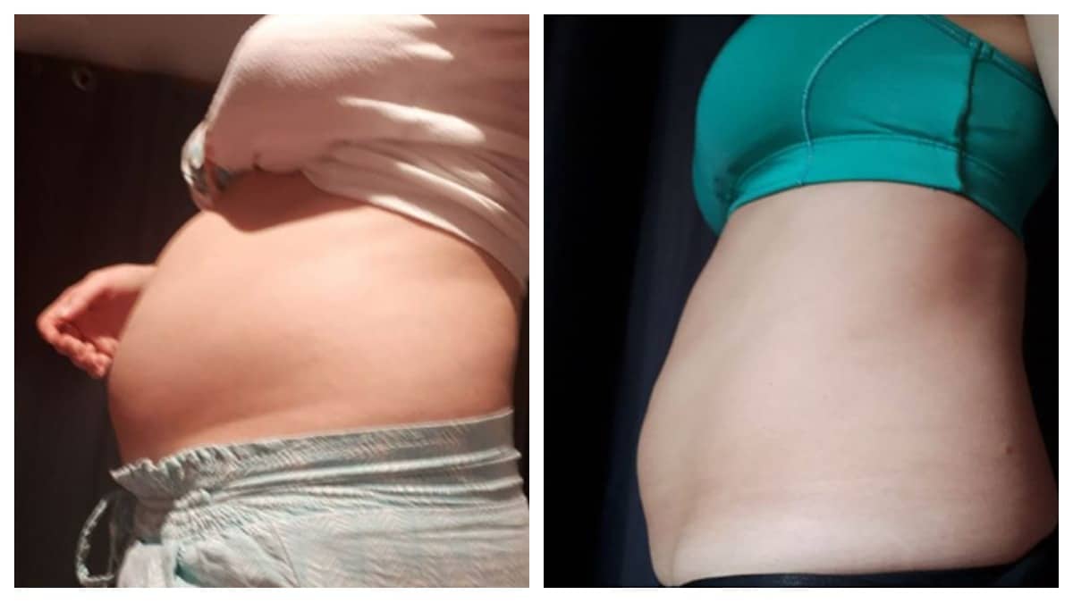 Avant et après avec la méthode The Belly Lab