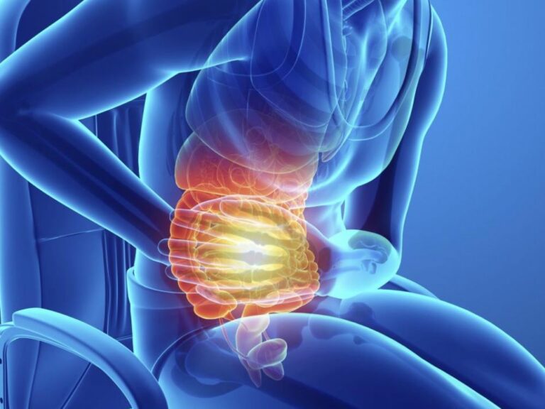 Côlon irritable atténuez vos douleurs avec The Belly Lab